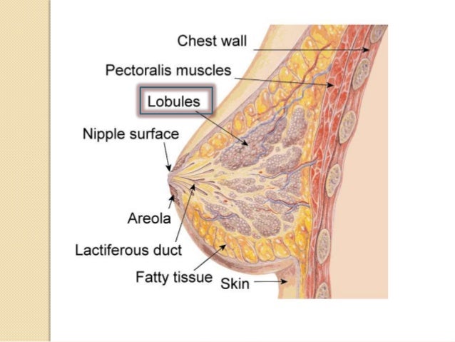 breast cancer situ Breast cancer situ